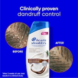 Head & Shoulders Coconut Dandruff Shampoo - 370 ml | Loblaws