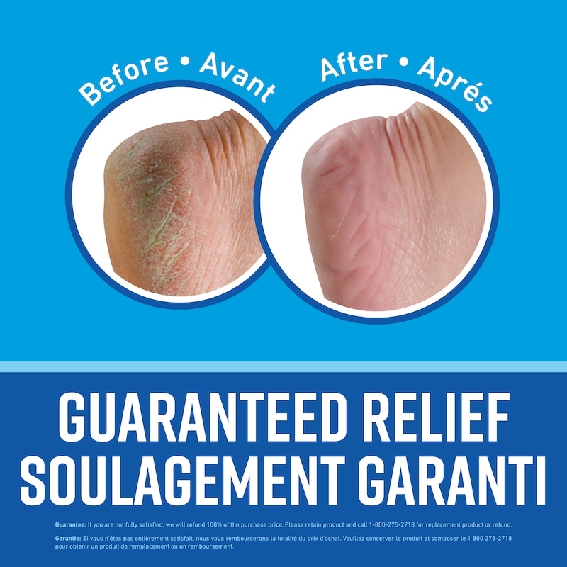 Healthy Feet Foot Cream