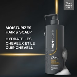 Dove Anti‑Dandruff 2‑in‑1 for Dry, Itchy Scalp - 530 ml | Atlantic