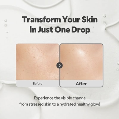 Sos Serum