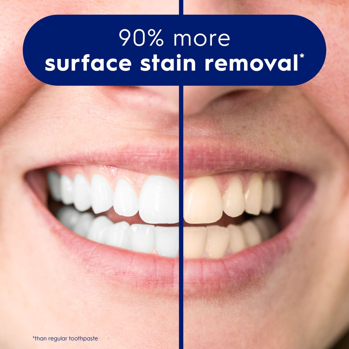 Crest 3D White Advanced, Teeth Whitening Toothpaste Arctic Fresh