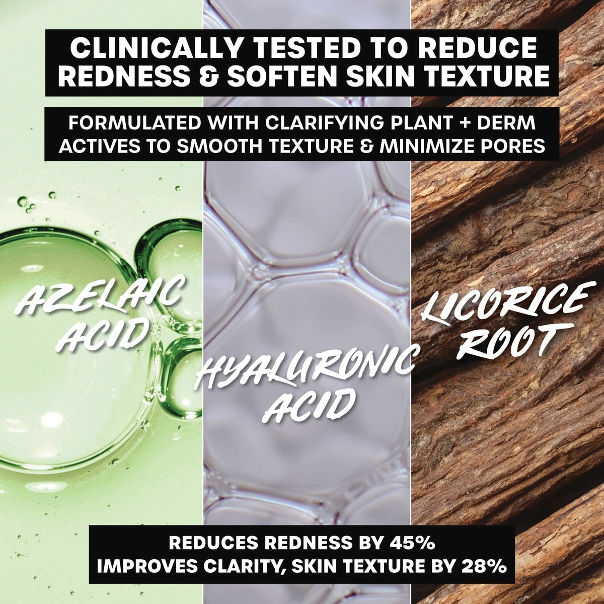 Let's Be Clear Water Face Cream, Moisturizer with Azelaic Acid and Hyaluronic Acid
