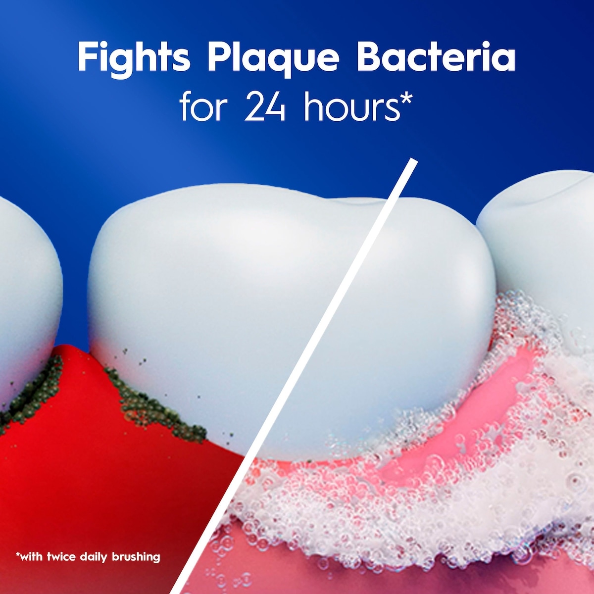 Gum and Sensitivity, Sensitive Toothpaste All Day Protection