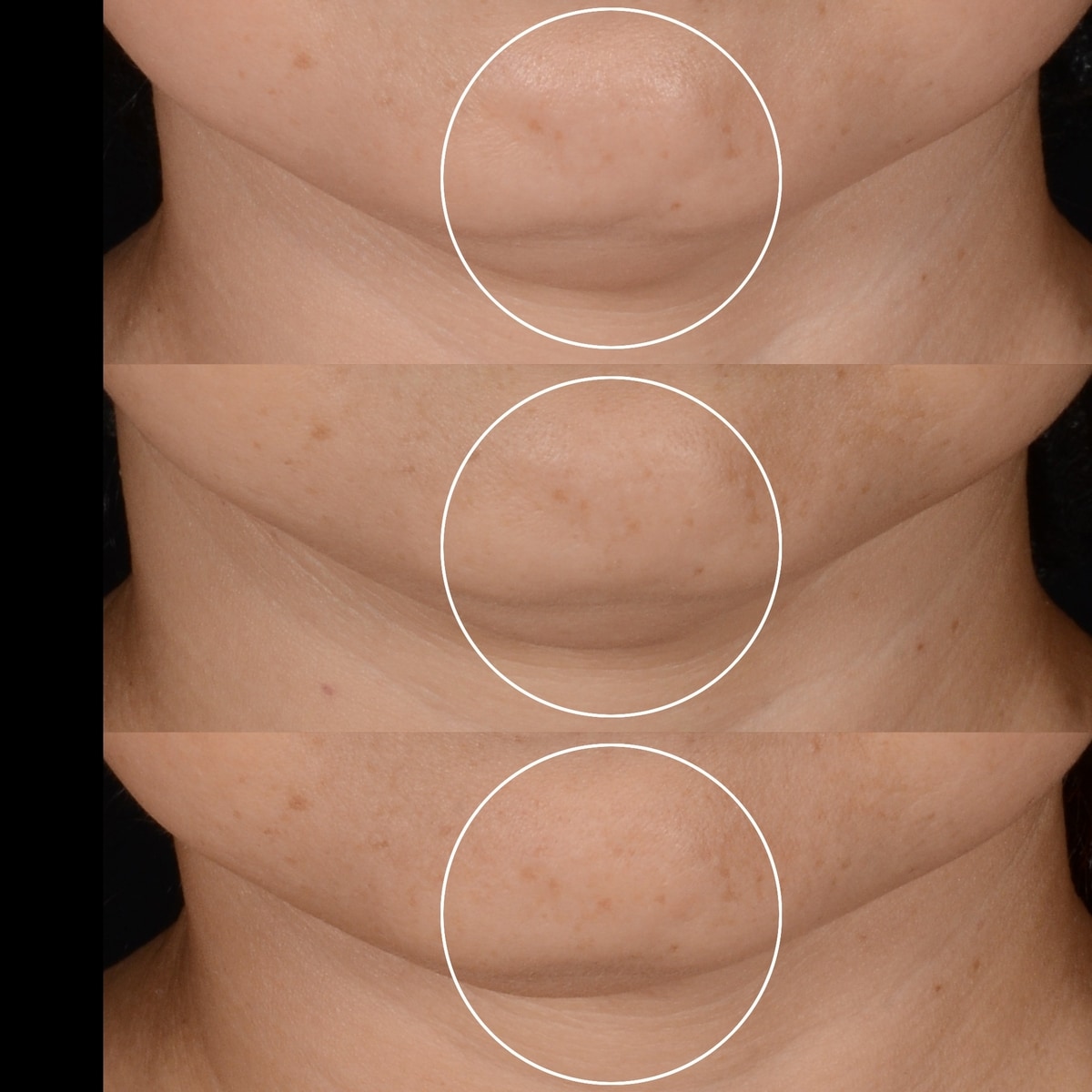 Rénergie H.P.N. 300-Peptide Cream & Refill Holiday Set