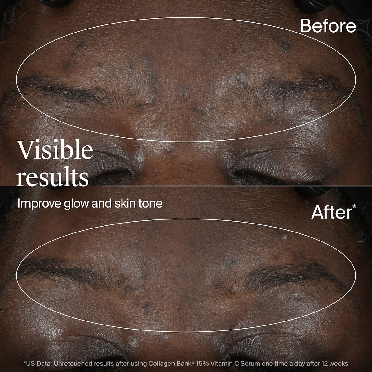 Collagen Bank 15% Vitamin C Serum