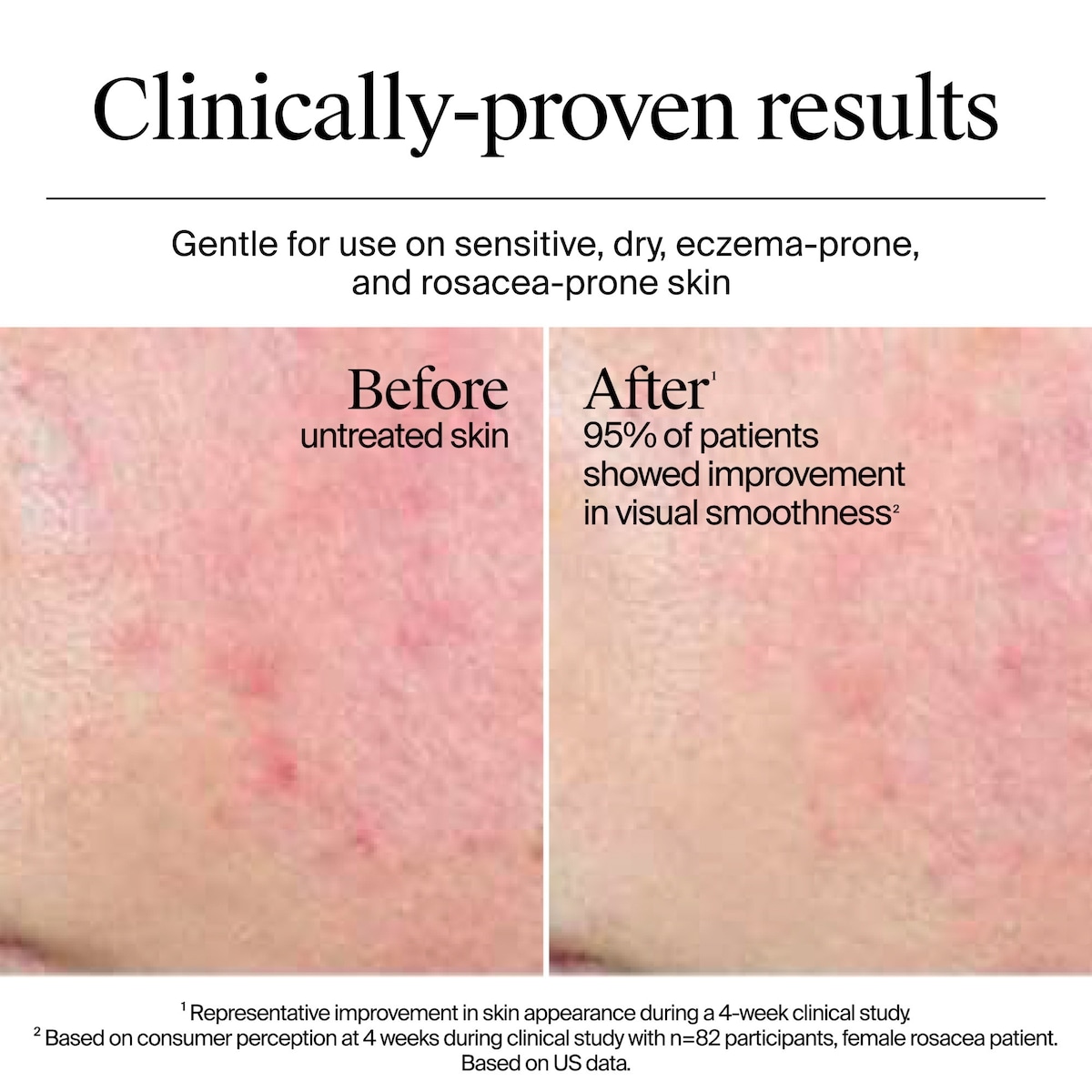 Gel-crème peau ultrasèche Hydro Boost, sans parfum