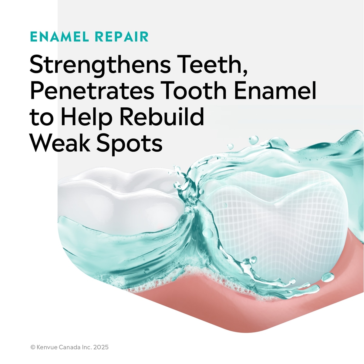Solutions cliniques Répare-émail à la menthe