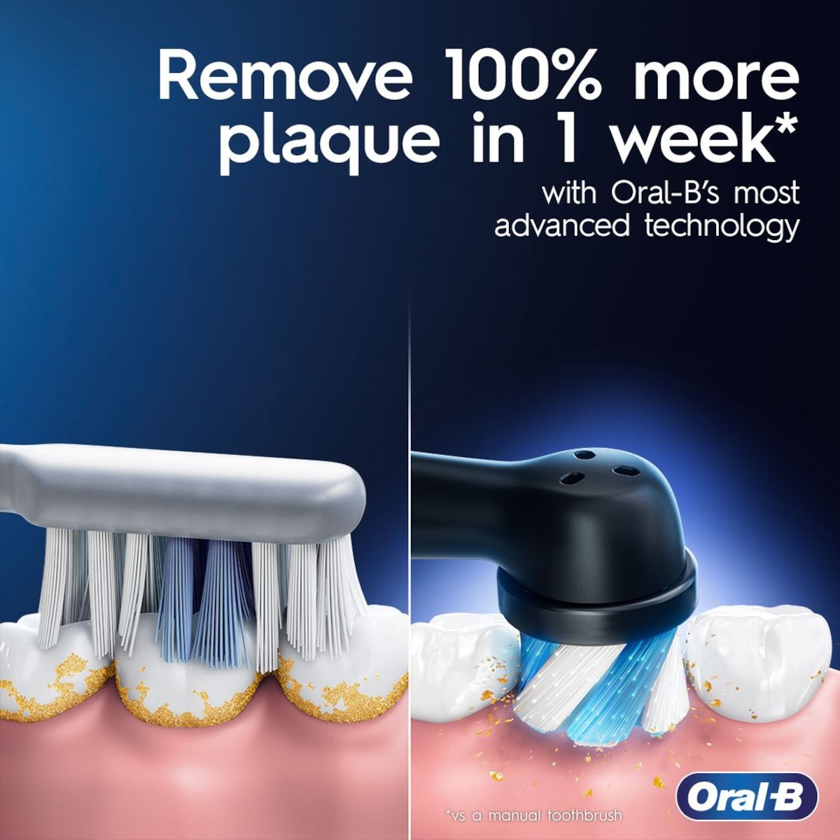 Brosse à dents électrique avec 4 brossettes Oral-B iO Series 9, onyx noir