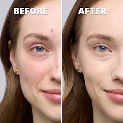 Perfect Corrector 3
