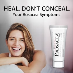 Rosacea Treatment Gel 4