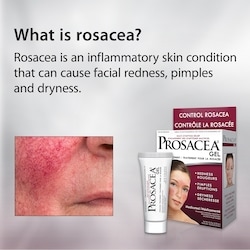 Rosacea Treatment Gel 6