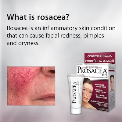 Rosacea Treatment Gel 6