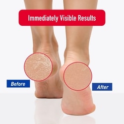 Superior Moisturizing Foot Cream 4