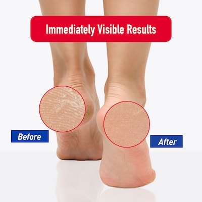 Superior Moisturizing Foot Cream 4