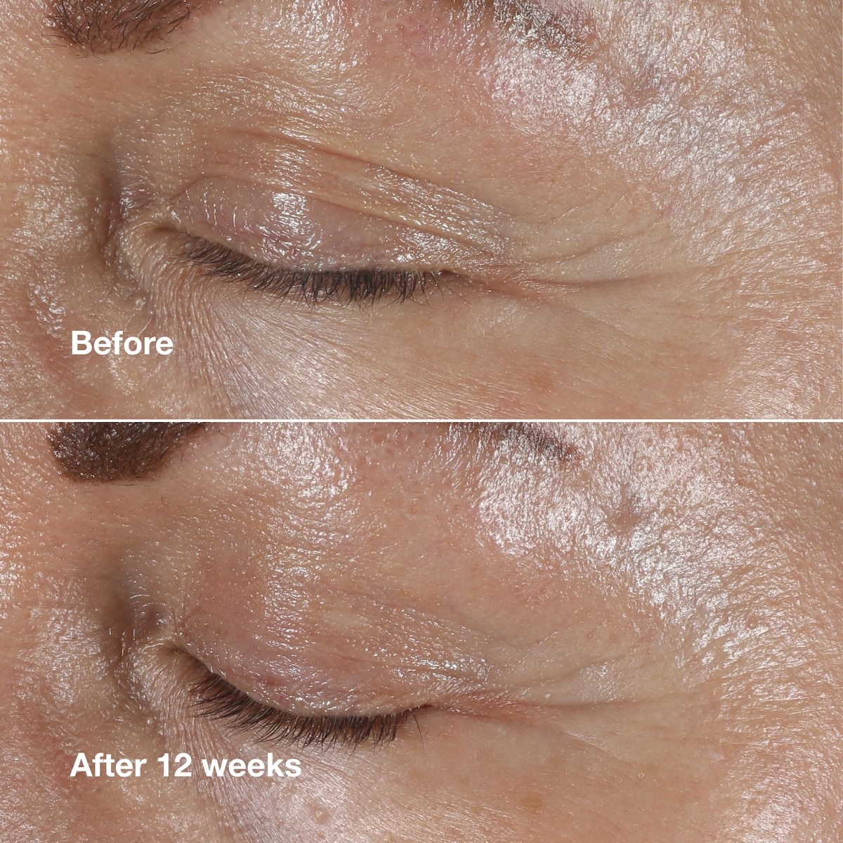 Smart Clinical Repairᴹᴰ Crème pour les yeux