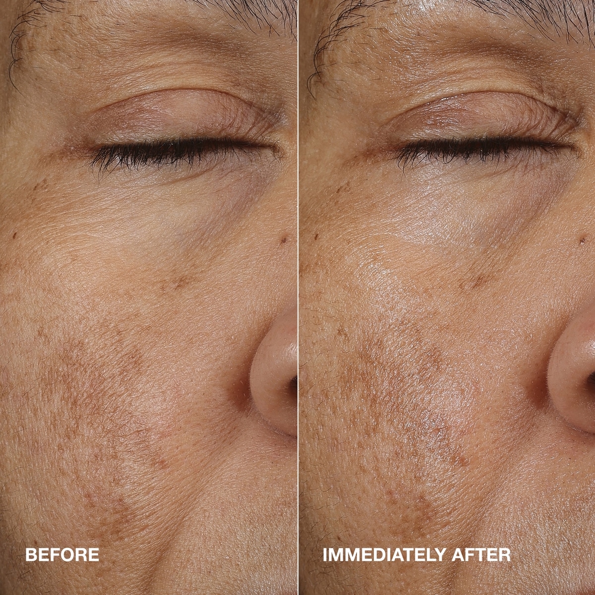 Moisture Surge™ Active Glow Serum