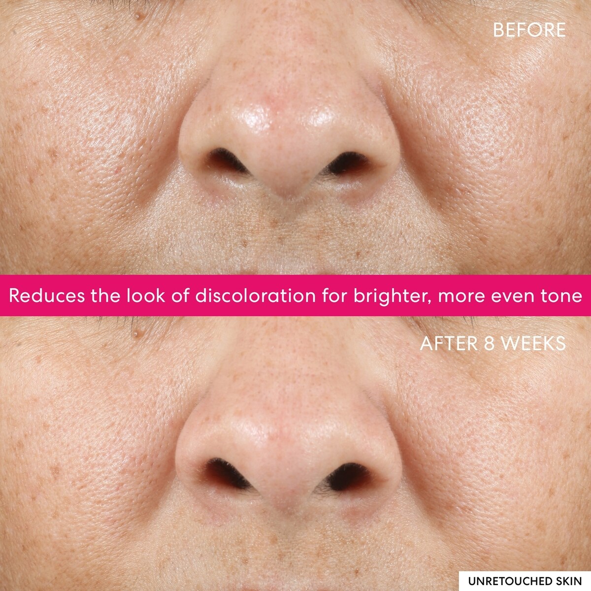 Ageless 10% Phyto-Lactic Radiance Facial