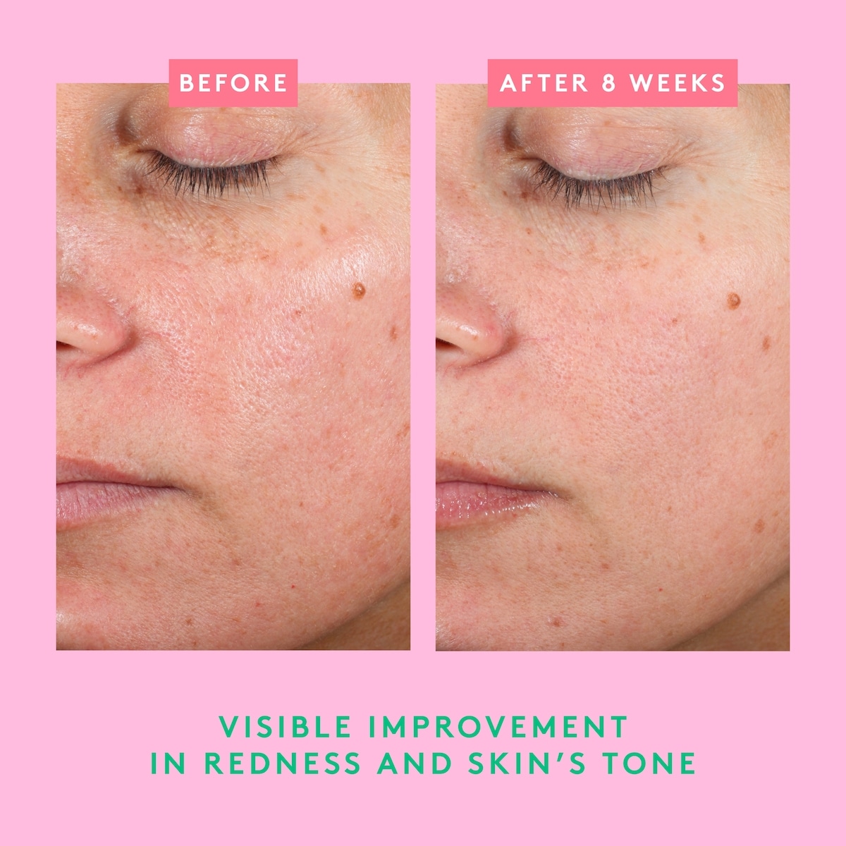 Bora Barrier™ Repair Cream