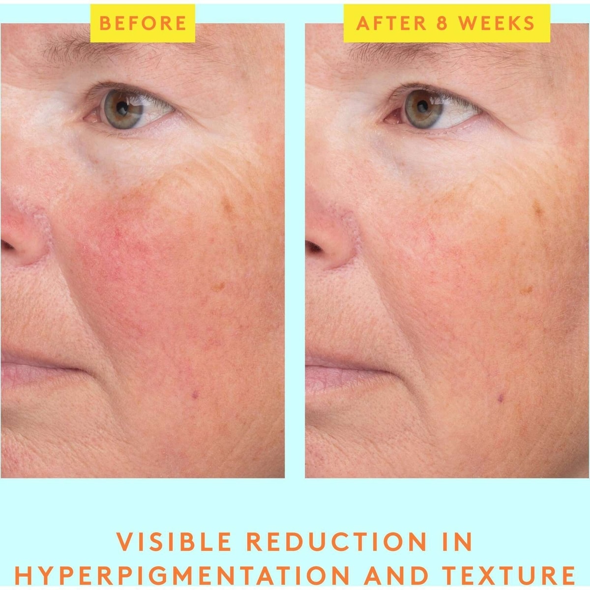 C-Luma™ Hydrabright Serum