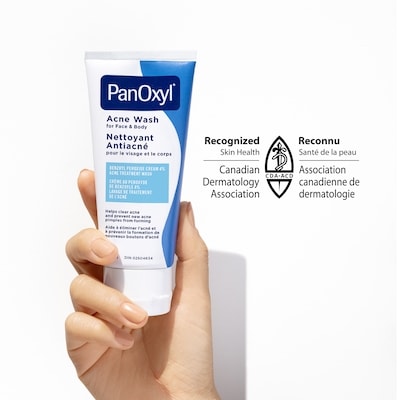 4% Benzoyl Peroxide Acne Wash, Helps Clear Acne 2