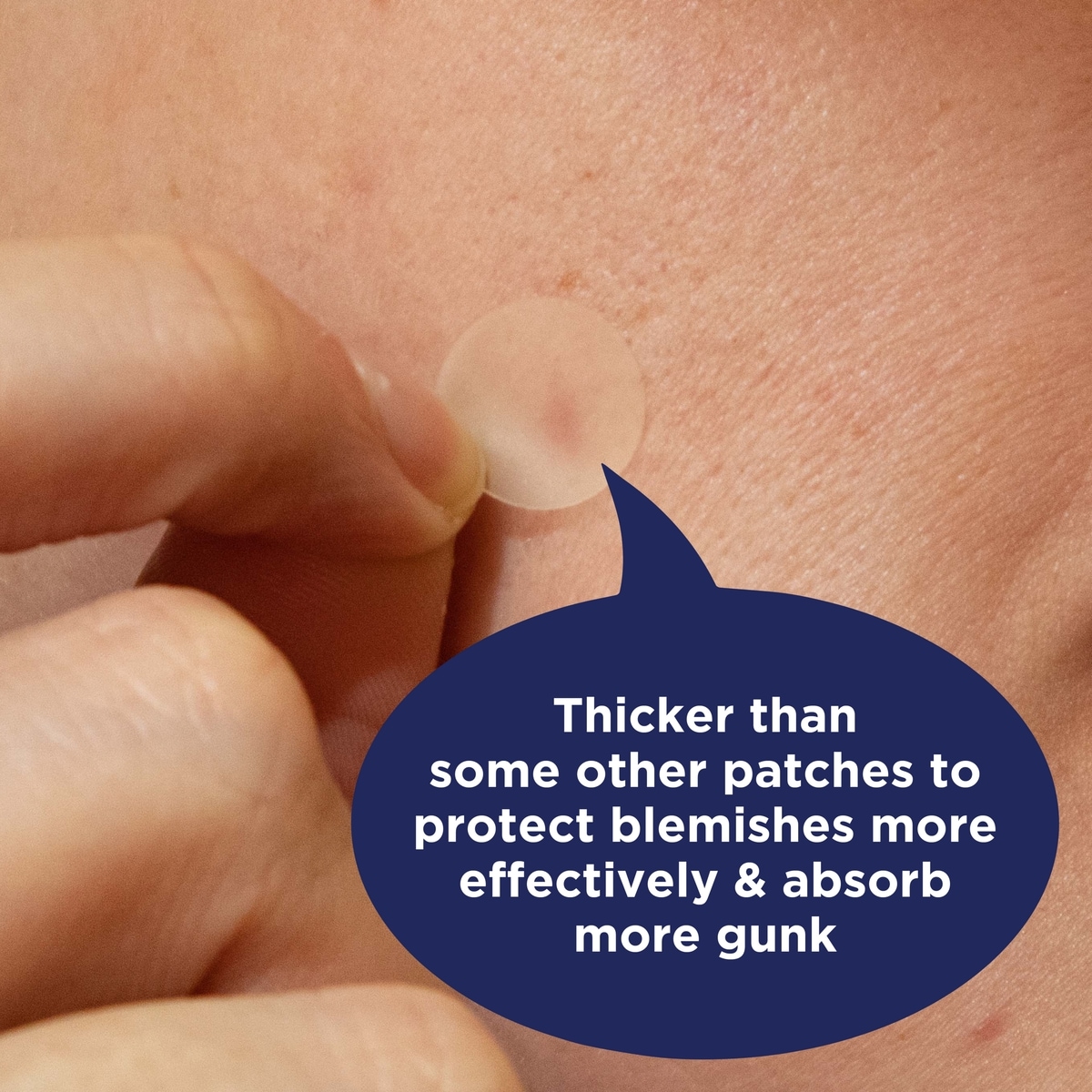 Overnight Spot Patches, Clear Hydrocolloid