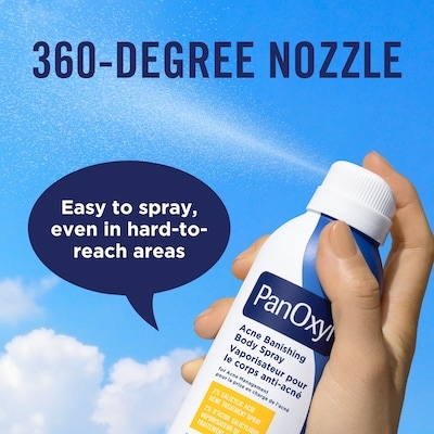 Acne Banishing Body Spray with 2% Salicylic Acid 6