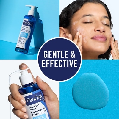 Acne Gel Wash, 2% Salicylic Acid, Helps Clear Acne 4