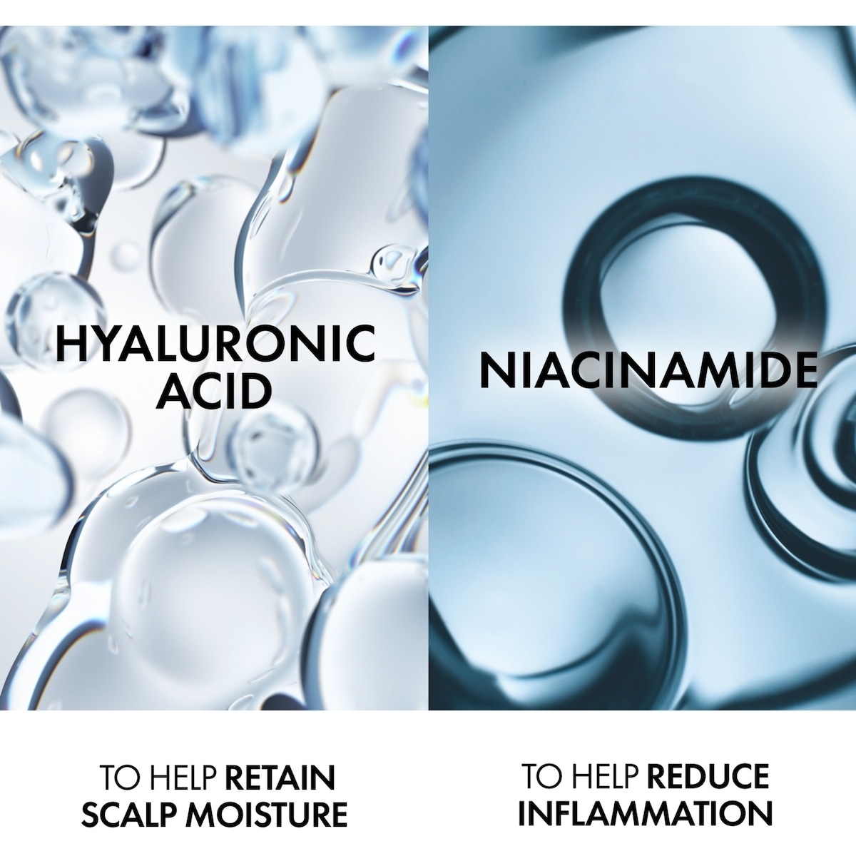 Vichy Dercos Anti-Dandruff Hydrating Conditioner for Dry & Sensitive Scalp