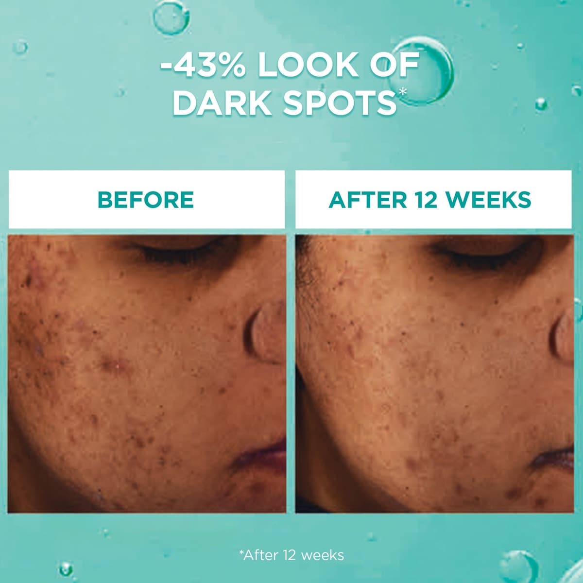 Bright Reveal Sérum Taches Brunes avec 12% Niacinamide + Acide Amino Sulfonique + Acide Ferulique
