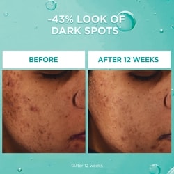 Bright Reveal Dark Spot Face Serum with 12% Niacinamide + Ferulic + Amino Sulfonic Acids 5