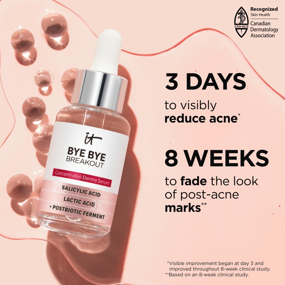 Bye Bye Breakout Traitement pour l'acné avec 2% d'acide salicylique
