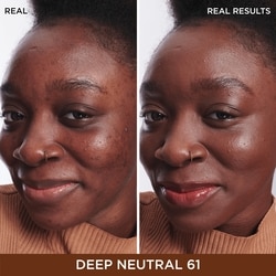 Bye Bye Dark Spots Concealer + Serum with 2% Niacinamide

INSTANT NATURAL COVERAGE + CLINICALLY FADES DRAK SPOTS* 3