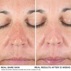 Bye Bye Dark Spots Concealer + Serum with 2% Niacinamide

INSTANT NATURAL COVERAGE + CLINICALLY FADES DRAK SPOTS* 6
