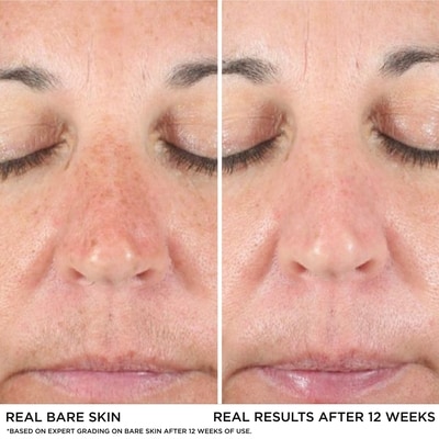 Bye Bye Dark Spots Concealer + Serum with 2% Niacinamide
INSTANT NATURAL COVERAGE + CLINICALLY FADES DRAK SPOTS* 6