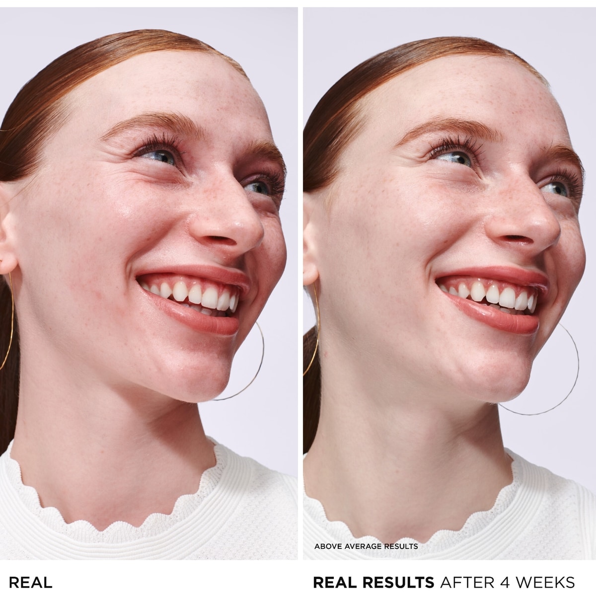 Bye Bye Redness Serum - Instant Relief for Sensitive Skin with Niacinamide