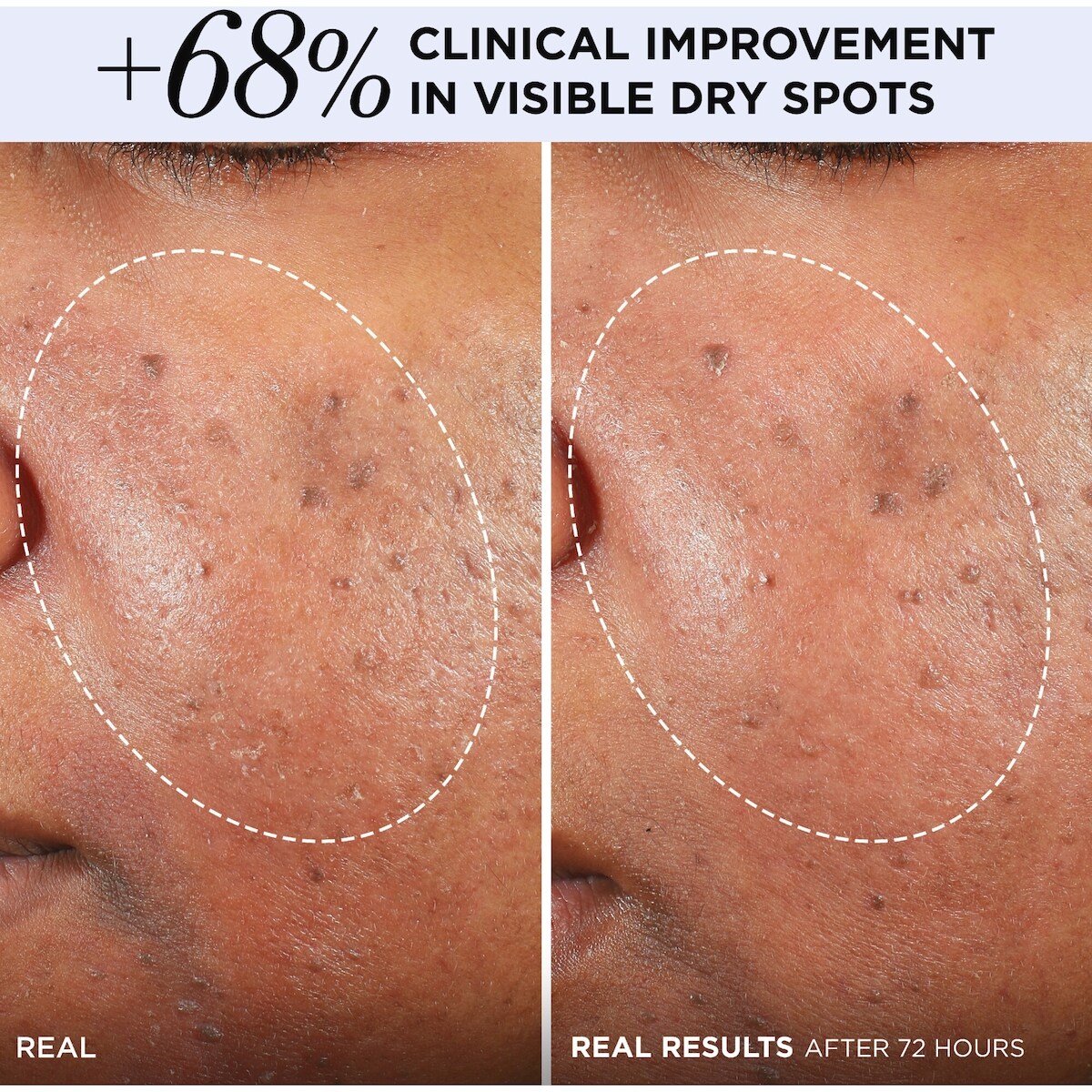 Crème hydratante Confidence in a Cream Barrier Boost