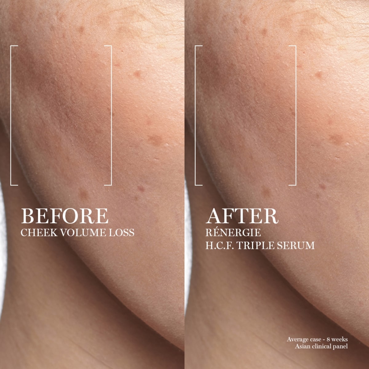 Rénergie H.C.F. Triple Serum with Hyaluronic Acid