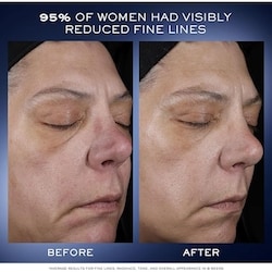 Génifique Ultimate Serum Refillable
With Beta Glucan-CM technology 5