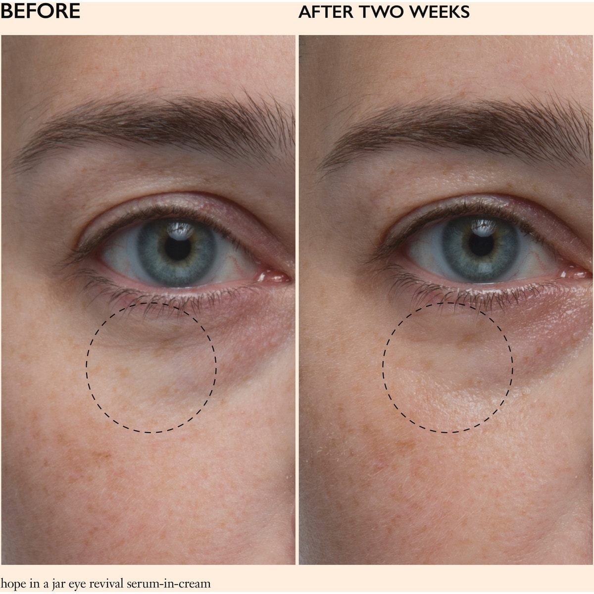 hope in jar eye-revival serum-in-cream