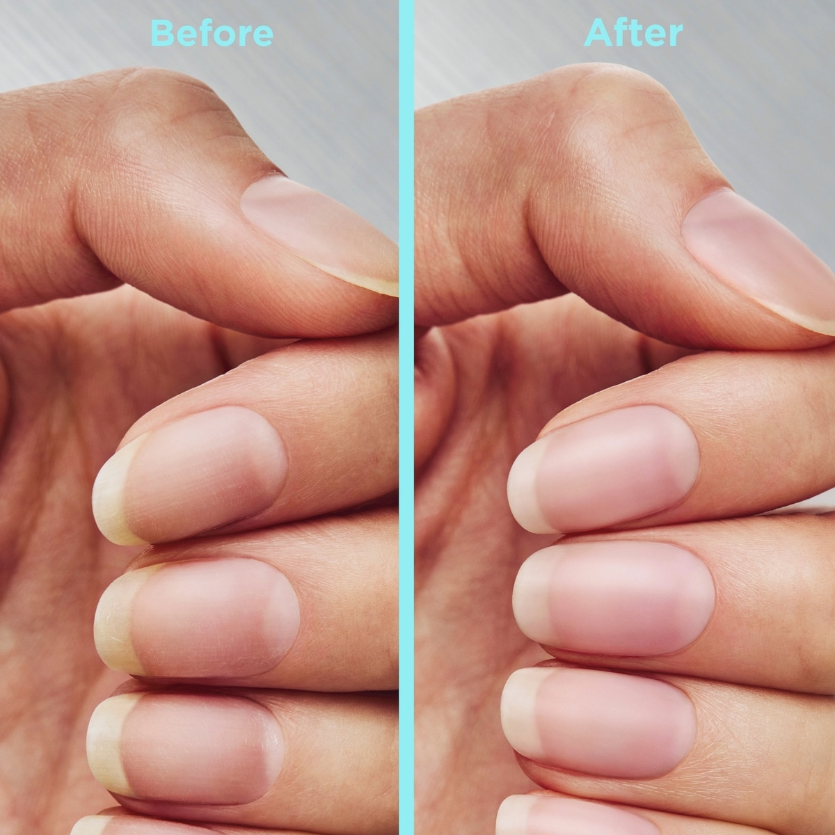 Sally Hansen - Repair + Rescue