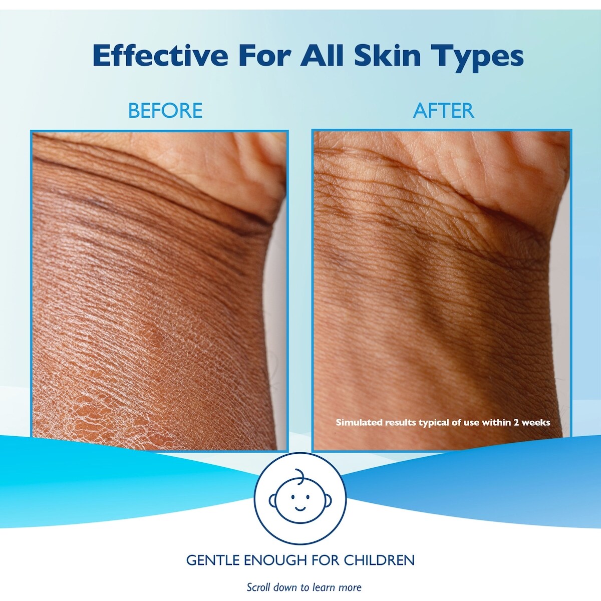 Base Glaxal Crème