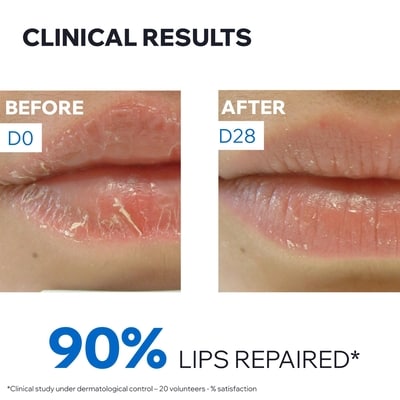 Bariéderm-Cica Protective Lip Balm 5