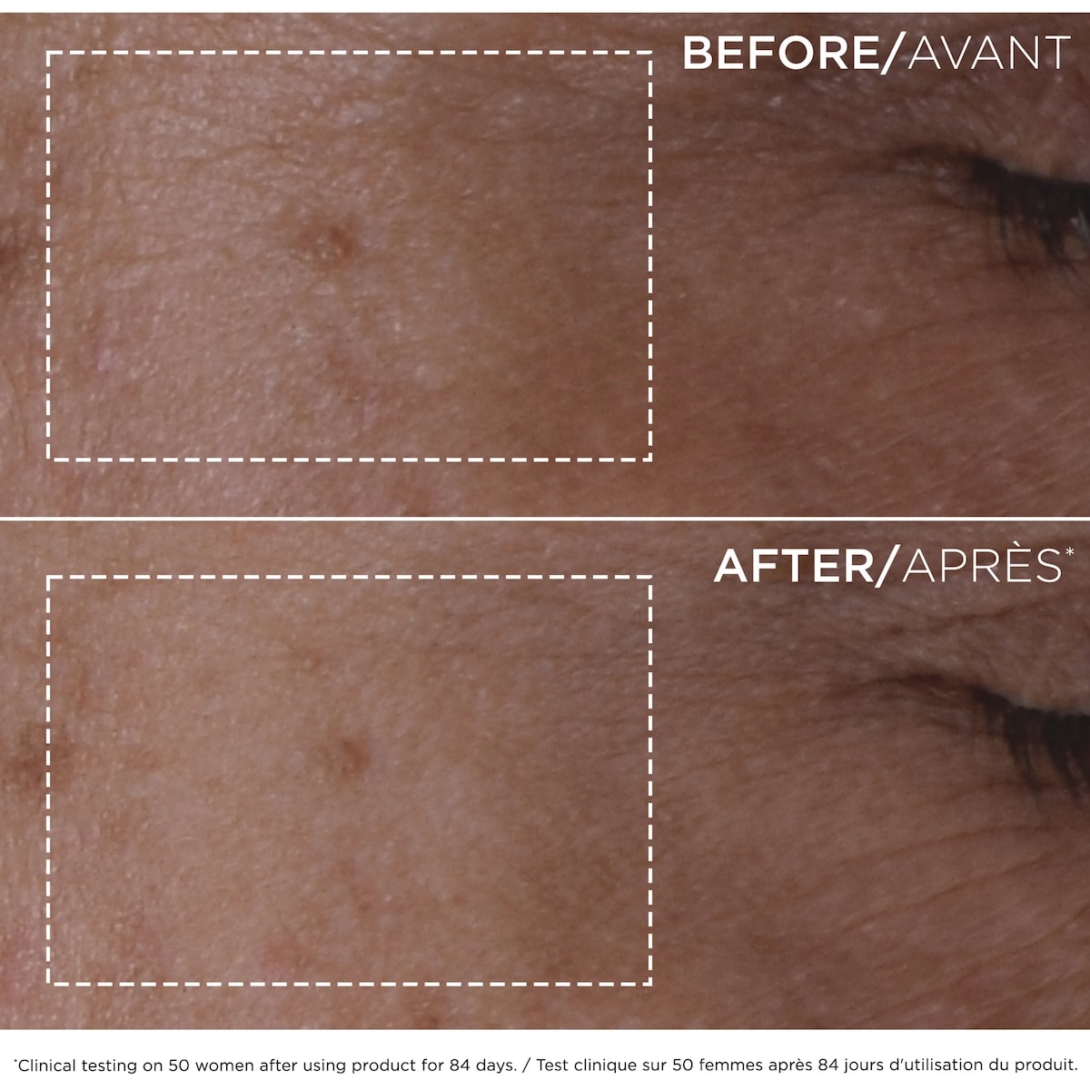 Double Serum