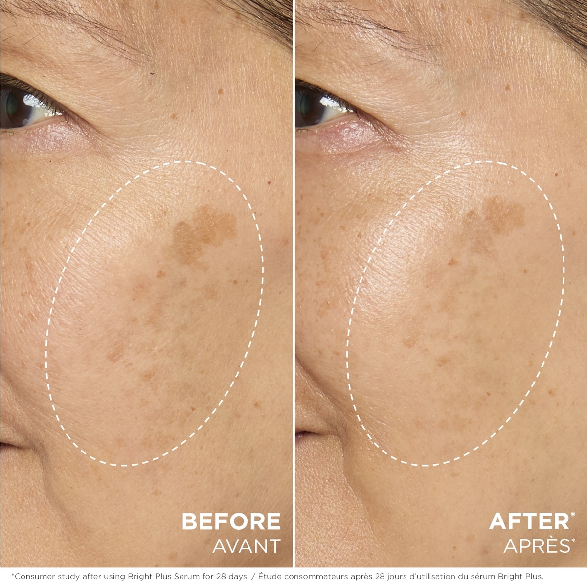 Sérum Bright Plus [Advanced