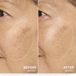 Bright Plus [Advanced] Serum 3