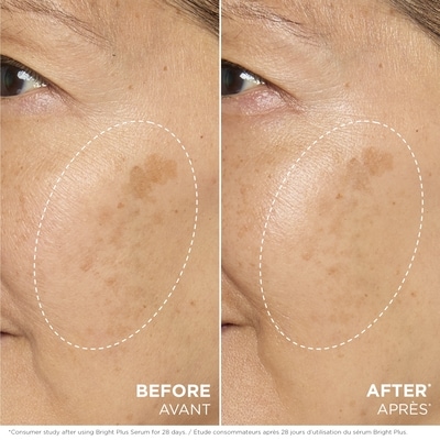 Bright Plus [Advanced] Serum 3