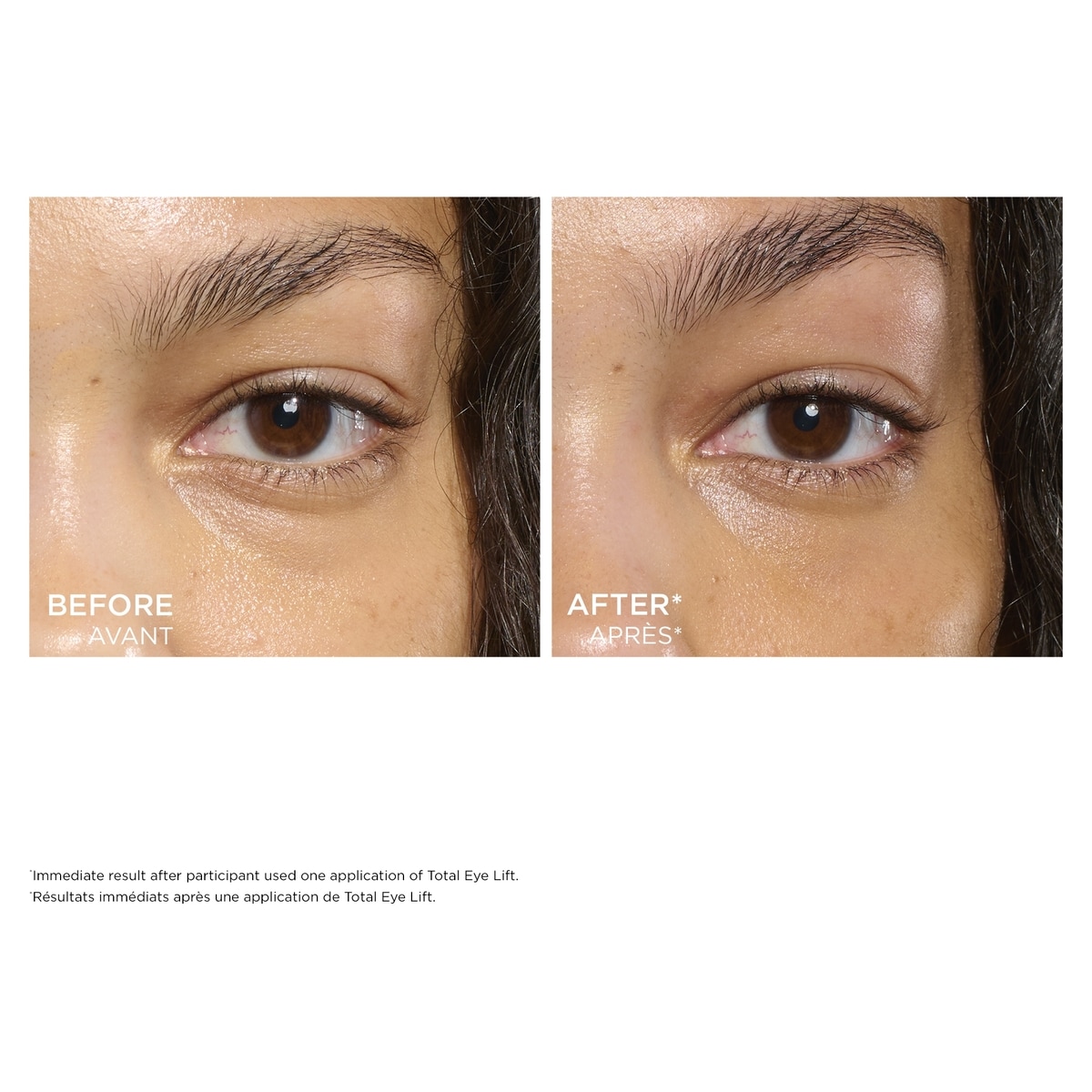 Total Eye Lift Refill