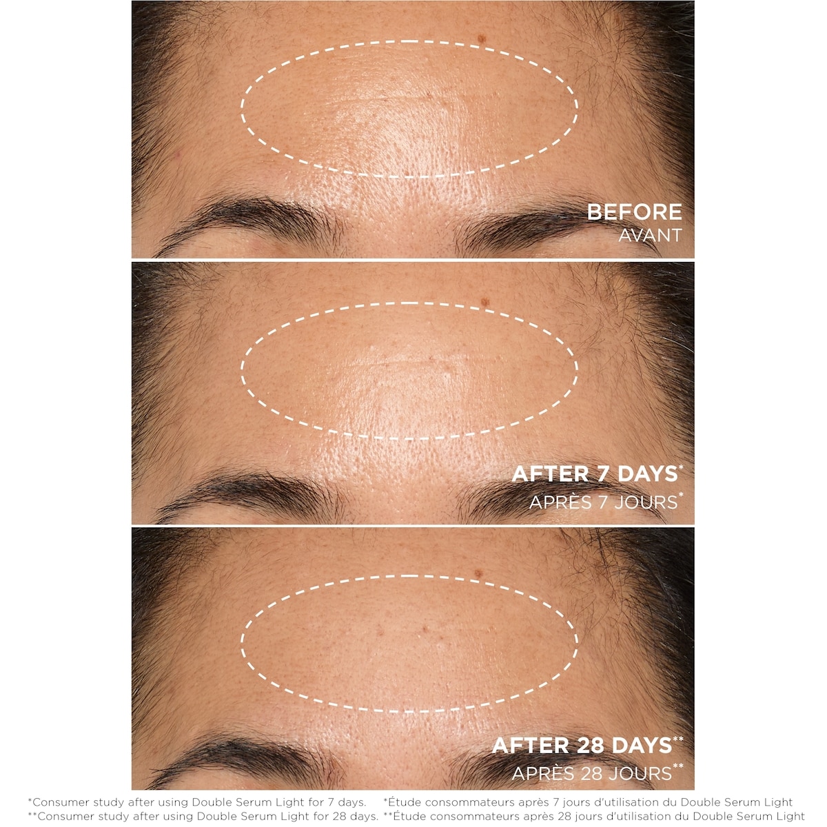 Double Serum Light Texture