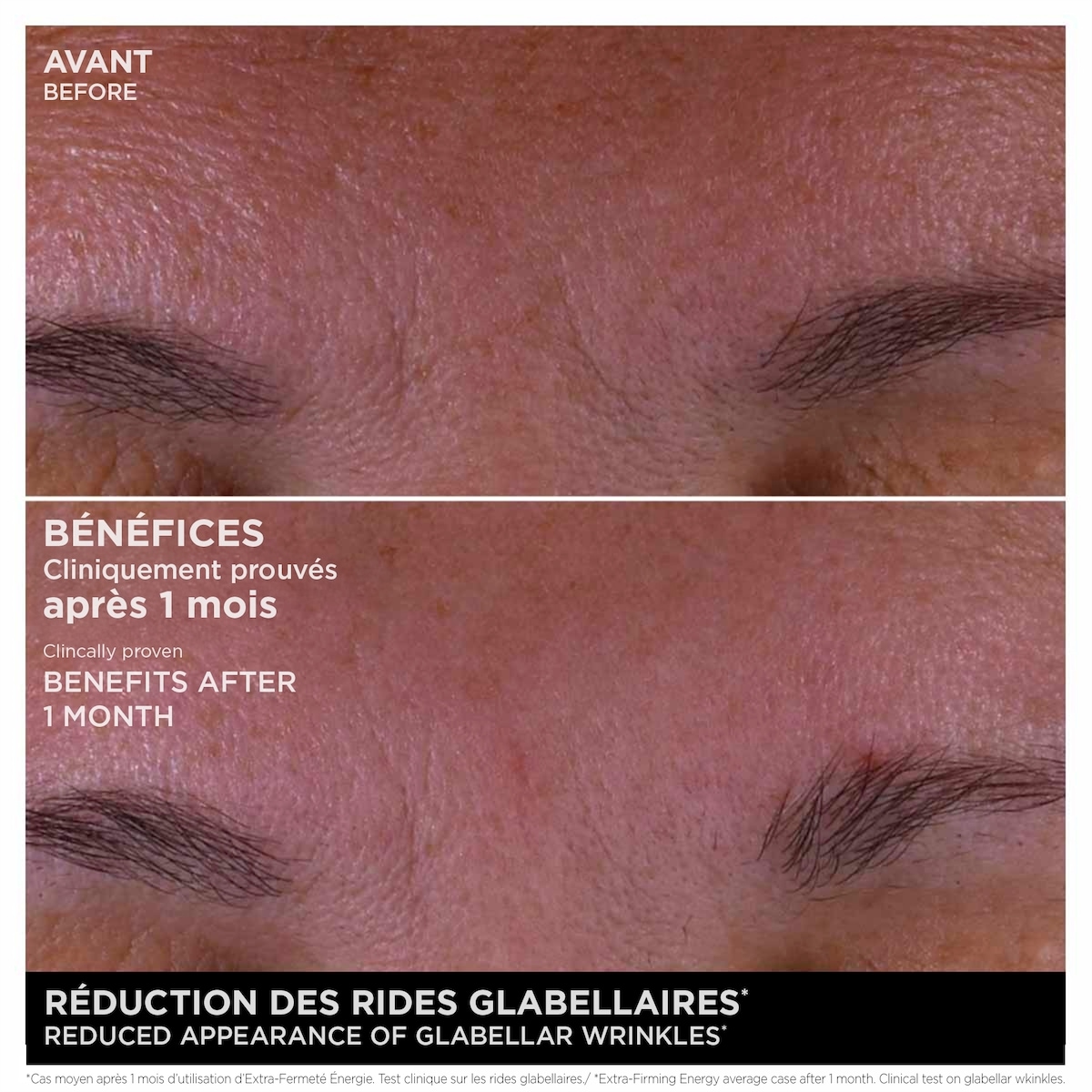 Extra-Firming Energy