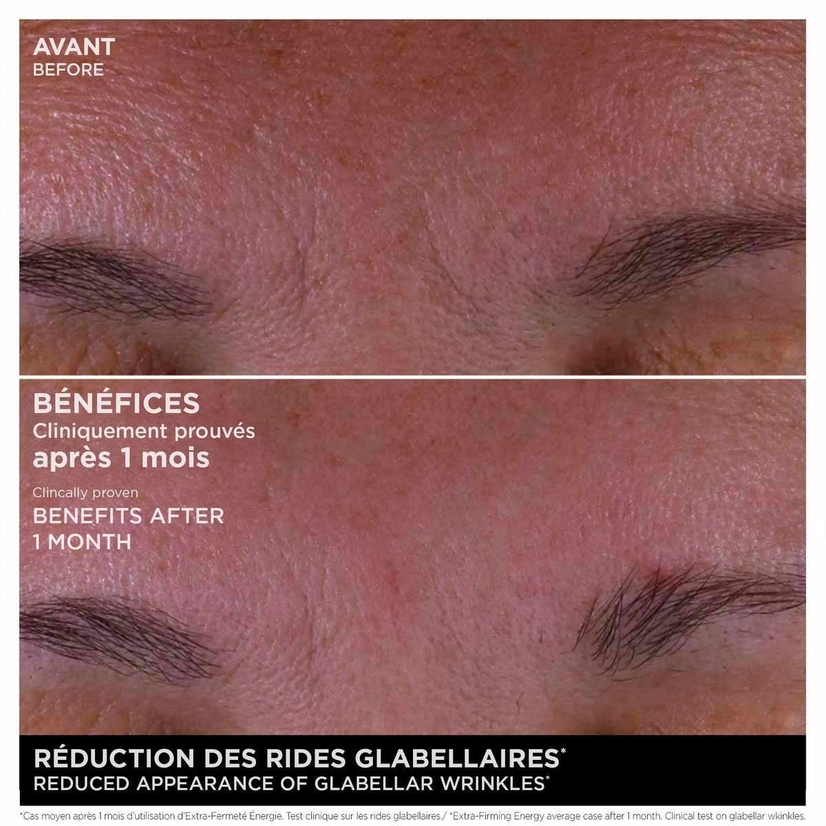 Extra-Fermeté Énergie Recharge